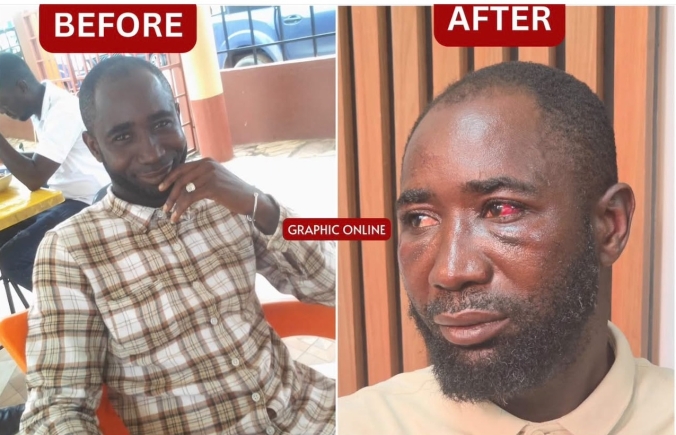 VIDEO: Before and after alleged police brutality of a Graphic staff in Accra