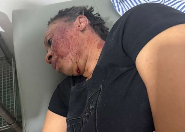 'I nearly lost my life' – Adwoa Safo recounts Kwabenya Shooting Incident