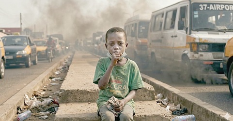A sickly child whose he• A sickly child whose health condition has resulted from inhalation of dangerous exhaust fumesalth condition has resulted from inhalation of dangerous exhaust fumes