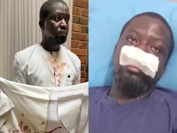 IGP orders probe into alleged police assault on Ibrahim Mahama in Tamale