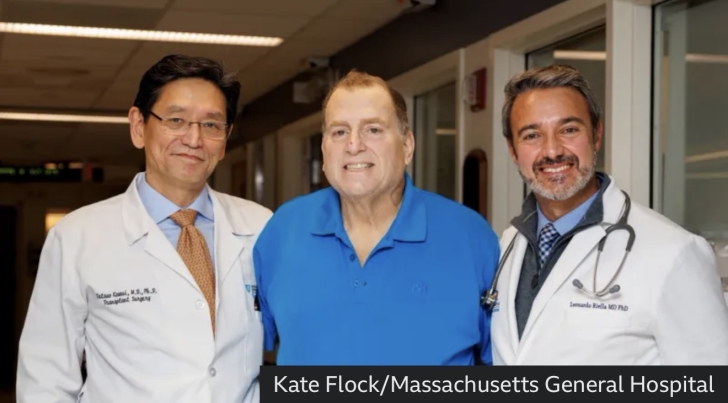 Transplanted pig kidney works in US man's body for record 271 days