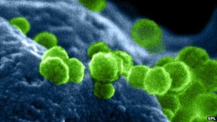 HIV, in green, bursting out of a white blood cell it has hijacked