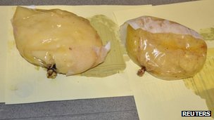 The plastic bags of an implant contained 1.4kg of cocaine.