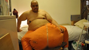 Doctors weighed the mass they removed from Wesley Warren; it came in at 132 pounds. 