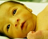 Neonatal jaundice  – a dangerous but preventable affliction of newborns