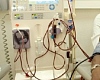 University of Ghana study links West African gene to higher kidney disease risk