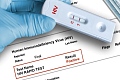 Wrong manufacturer, wrong dates: How to spot the falsified HIV test kits flooding Ghana's market