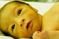 Any baby with untreated severe jaundice is at risk of brain damage from the jaundice