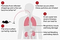 How worried should we be about hantavirus?