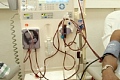 University of Ghana study links West African gene to higher kidney disease risk