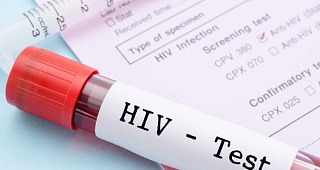 National HIV Estimates: 15,290 new infections recorded in 2024