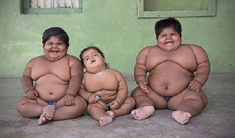 One in 10 children worldwide obese 