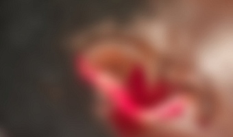 Oti Region: Woman loses ear after husband’s alleged attack