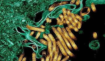 Nearly 2,300 people died in DR Congo's deadliest Ebola outbreak between 2018 and 2020