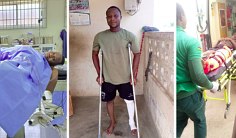 Brutal galamsey attack: - Forest guard battles for livelihood