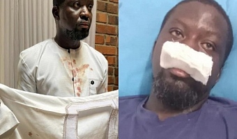 IGP orders probe into alleged police assault on Ibrahim Mahama in Tamale