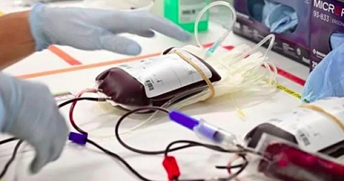 Jehovah's Witnesses can have their own blood removed for pre-planned surgeries