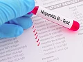 New Hepatitis B drug approved by US FDA offers patients a chance to ditch lifelong medication