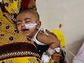 Bangladesh is facing its worst measles outbreak in decades