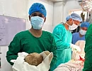 Doctors in Sri Lanka have removed a giant bladder stone that weighs as much as a newborn child