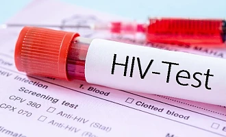 1,300 applicants tested HIV positive in security agency recruitment – Minister