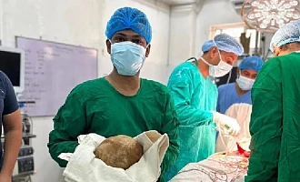 Doctors in Sri Lanka have removed a giant bladder stone that weighs as much as a newborn child