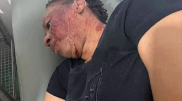 Photos of Adwoa Safo on a bed with blood in the face have been shared on social media.