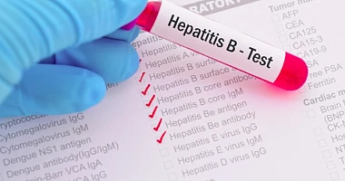 New Hepatitis B drug approved by US FDA offers patients a chance to ditch lifelong medication
